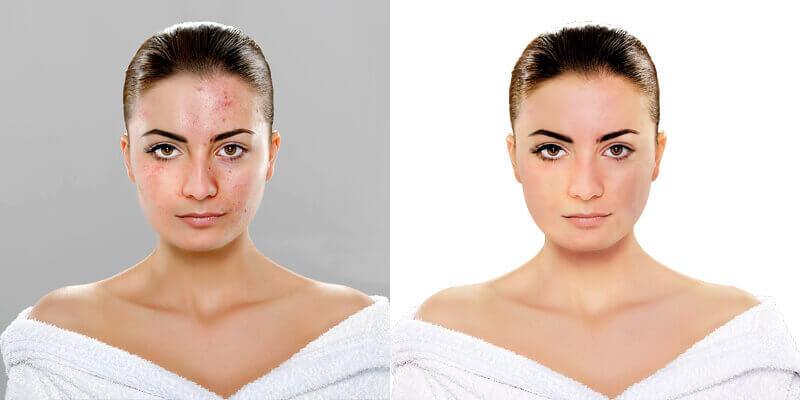 Product Photo Retouch Visible Impurities